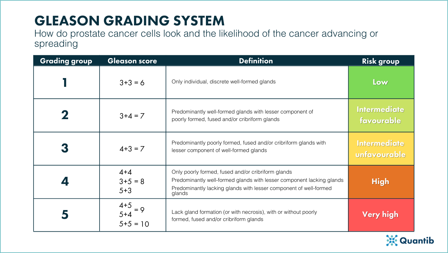 How Can Urologists Improve Patient Care In The Prostate Cancer Pathway?